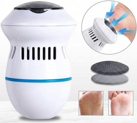 Removedor de Callos Eléctrico con Aspiración Integrada – Pies Suaves en Minutos